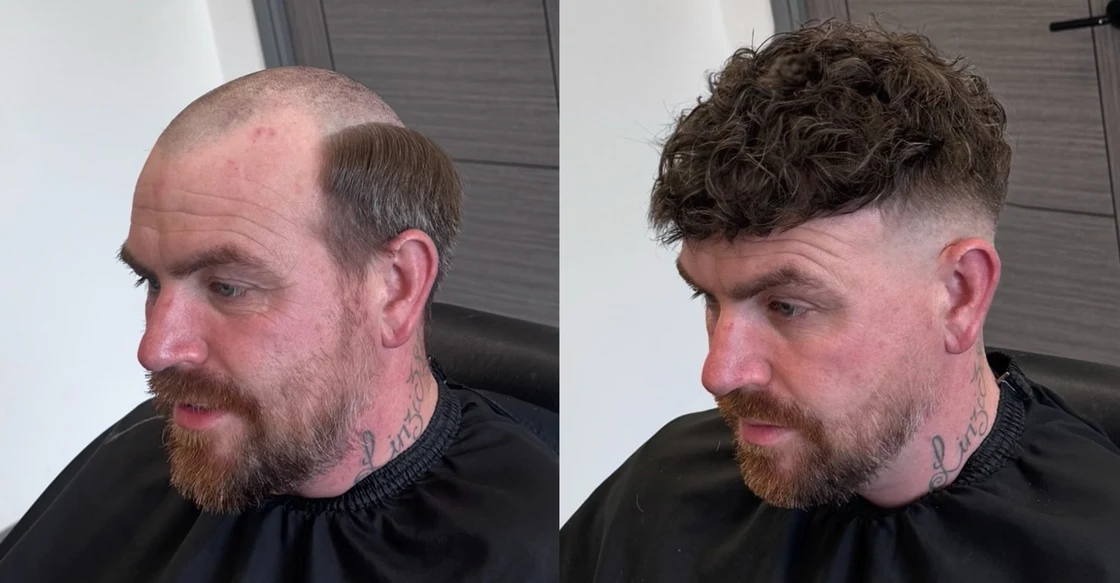 Before and after a hair system fitting at Rehair